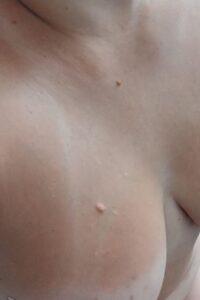 Эротический массаж